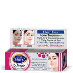 DOCTOR PIMPLE CREAM